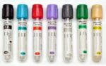 vacutainer tubes citrate Egyptian/أنابيب فاكيوتنر سيتريت محلي - Image 2