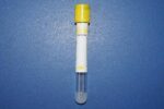 vacutainer tubes Gel Chinese/أنابيب فاكوتنر جيل صيني - Image 2