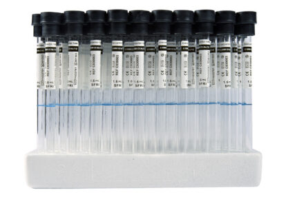 Vacutainer ESR Tubes chinese/ انابيب فاكيوتنر سرعة ترسيب صيني